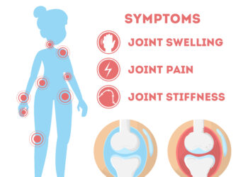 Kaip dehidratacija veikia reumatoidinį artritą?