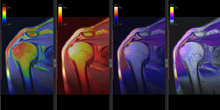 Peties kompiuterinė tomografija