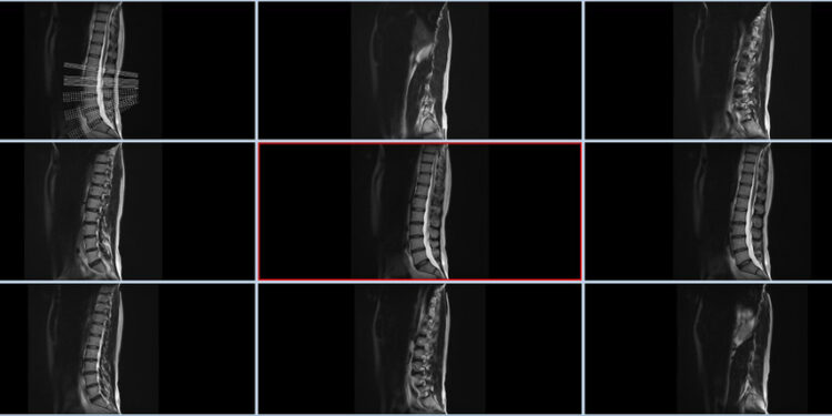 Rentgenogramą galima versti kaip „Rentgeno nuotrauka“ arba „rentgenologinis tyrimas“, o lumbosakralinę sritį – kaip „juosmens-kryžkaulio sritis“.  Taisyklingas, natūralus lietuviškas pavadinimas būtų:  **Juosmens ir kryžkaulio rentgeno nuotrauka**  arba  **Juosmens-kryžkaulio srities rentgeno tyrimas**