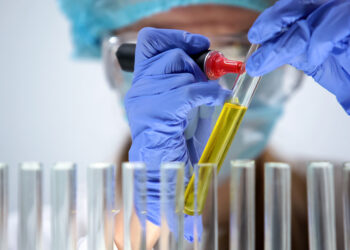 Šlapimo bilirubino tyrimas