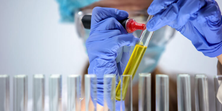 Šlapimo bilirubino tyrimas