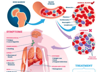 Ar leukemija gali sukelti padidėjusį cukraus kiekį kraujyje?