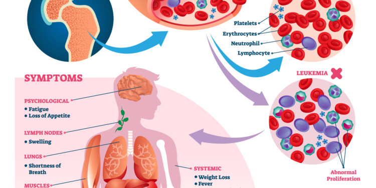 Ar leukemija gali sukelti padidėjusį cukraus kiekį kraujyje?