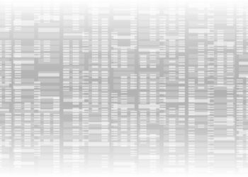 Baltymų elektroforezė šlapimo mėginyje
