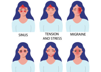 Galvos skausmai po nėštumo