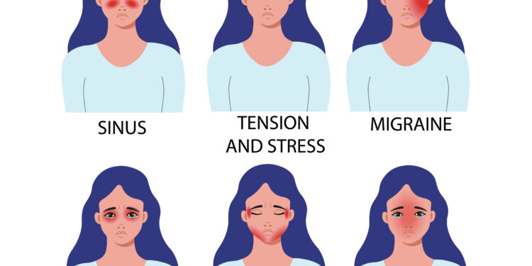 Galvos skausmai po nėštumo