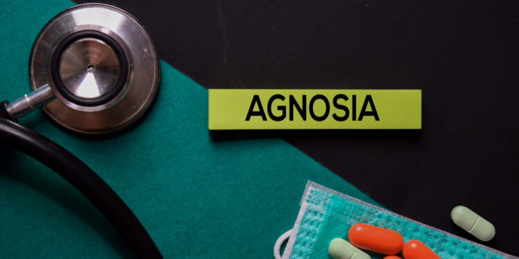 Kas yra apercepciogeninė agnozija?