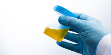 Šlapimo osmolingumo tyrimas