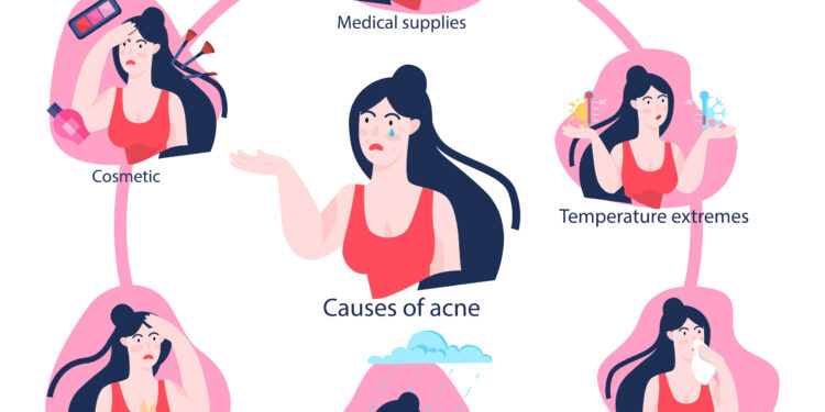 Per kiek laiko pasireiškia gonorėjos simptomai?
