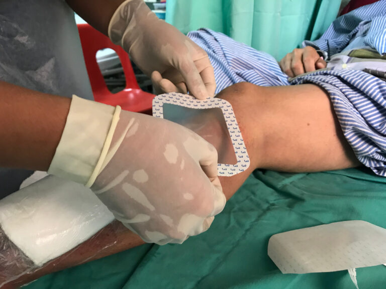 Ar galima užsikrėsti MRSA ant kojos?