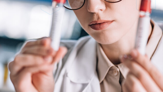 Ar įmanomas klaidingai teigiamas hepatito C testas?