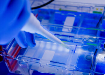 Serumo baltymų elektroforezės tyrimas