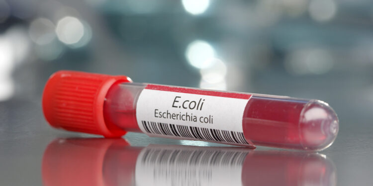 Ar E. coli yra užkrečiama?