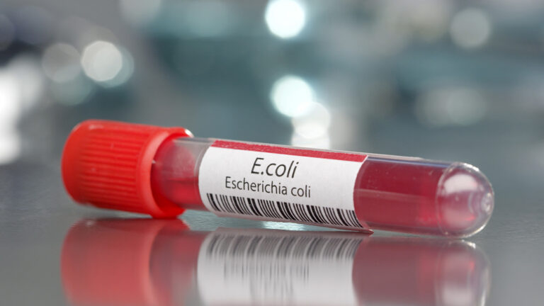 Ar E. coli yra užkrečiama?
