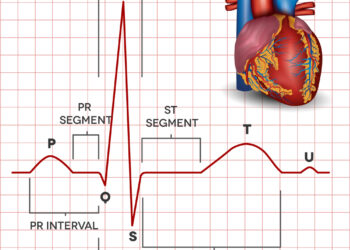 Prieširdžių virpėjimas ir plazdėjimas: kuo jie skiriasi?