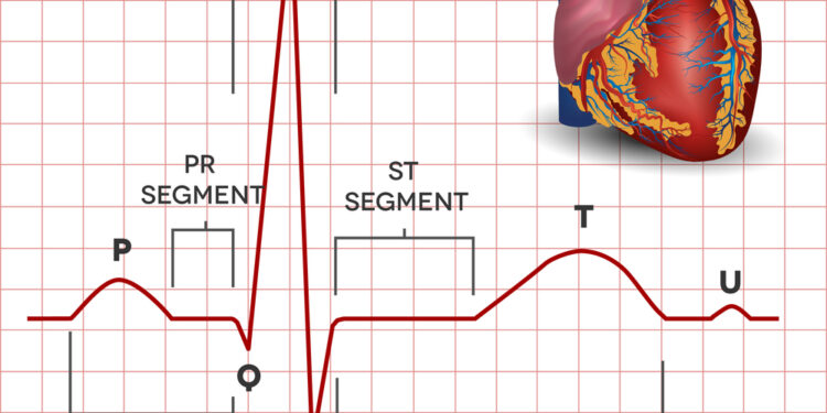Prieširdžių virpėjimas ir plazdėjimas: kuo jie skiriasi?