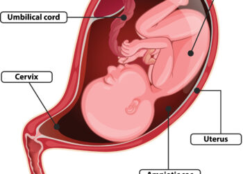 Pažintis su prievarčiu (piloriniu rauku)