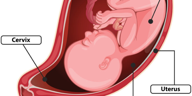 Pažintis su prievarčiu (piloriniu rauku)