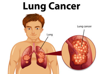 Ar niežtinti oda gali būti vėžio požymis?