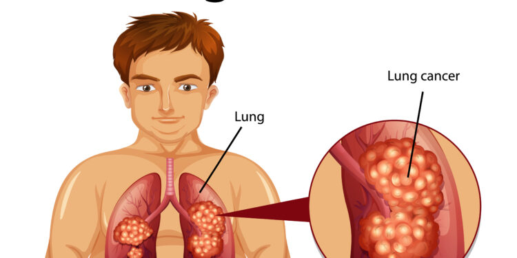 Ar niežtinti oda gali būti vėžio požymis?