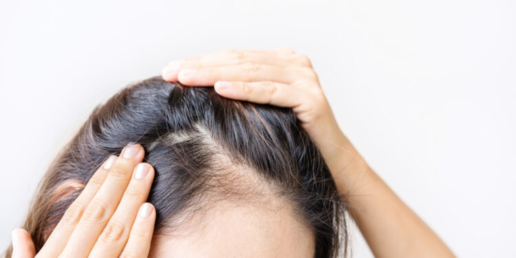 9 patarimai, kaip turėti sveikesnius ir tankiau atrodančius plaukus