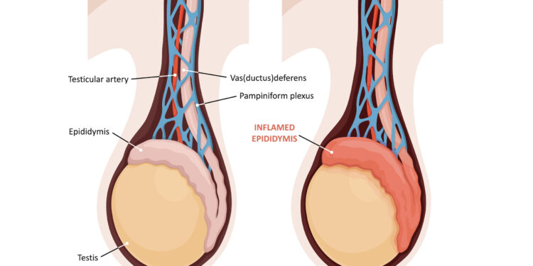 Lėtinės obstrukcinės plaučių ligos (LOPL) gydytojai
