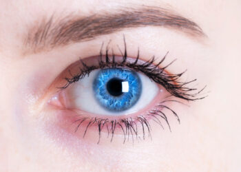 Kodėl aplink raineles atsiranda mėlyni žiedai?