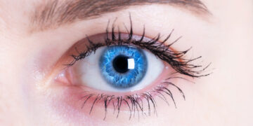 Kodėl aplink raineles atsiranda mėlyni žiedai?