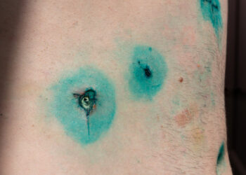 Įkvepianti tapyba: 7 tatuiruotės apie diabetą