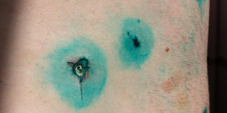 Įkvepianti tapyba: 7 tatuiruotės apie diabetą