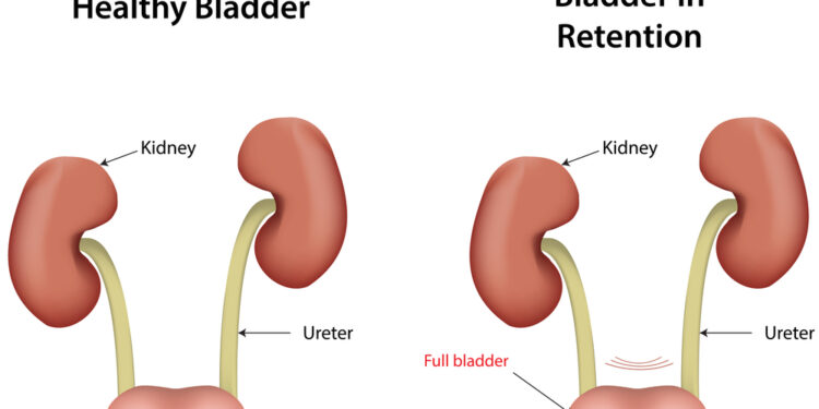 Revlimidas: nėštumas, žindymas ir kontracepcija