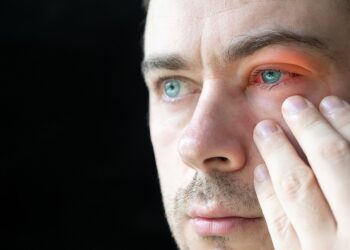 Kas yra medžiaginis (arba lininis) konjunktyvitas?