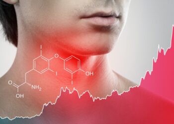 Limfmazgių uždegimas (limfadenitas)