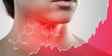 Limfmazgių uždegimas (limfadenitas)