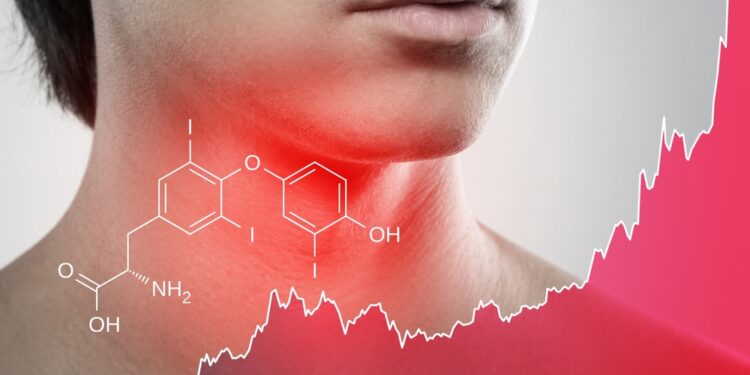 Limfmazgių uždegimas (limfadenitas)