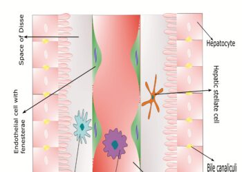 IV stadijos šlapimo pūslės vėžys: prognozė ir gyvenimo trukmė