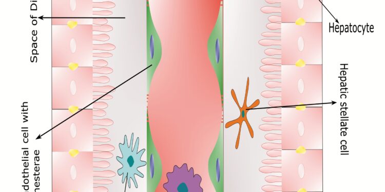 IV stadijos šlapimo pūslės vėžys: prognozė ir gyvenimo trukmė