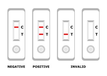 Antigenų testai: ką svarbu žinoti sergant diabetu