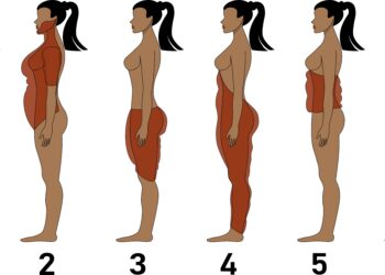 Kuprelė ties pečiais