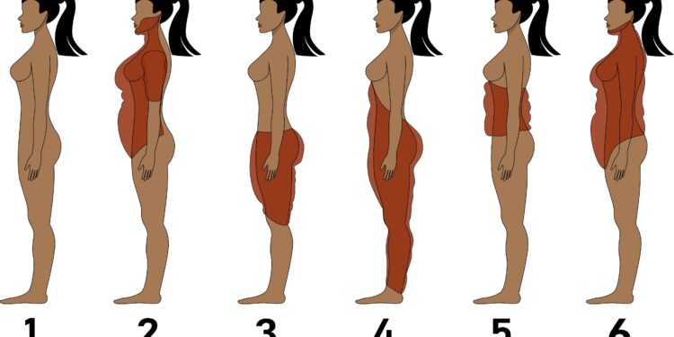 Kuprelė ties pečiais