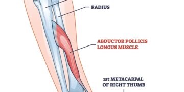 Trikampio kaulo lūžis