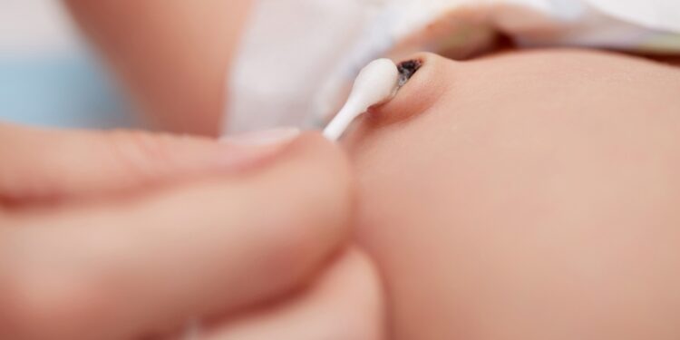 Kodėl kraujuoja mano naujagimio bamba?