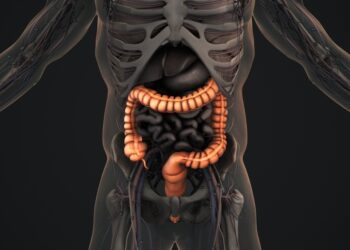 Blužnies linkio sindromas