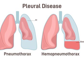 Kas yra vandenilio kvėpavimo testas?