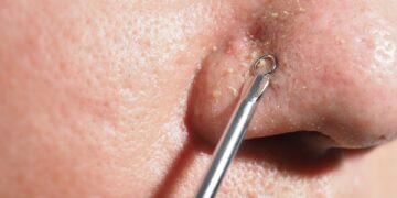 Kas tas raudonas taškelis ant mano nosies?