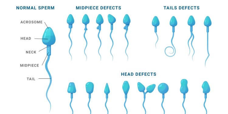 Kaip skonis spermos (arba sėklos)?