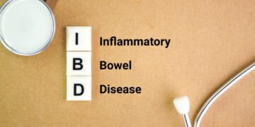 Kaip gydytojai nustato ir diagnozuoja dirgliosios žarnos sindromą?