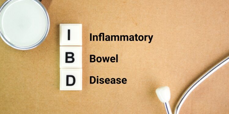 Kaip gydytojai nustato ir diagnozuoja dirgliosios žarnos sindromą?