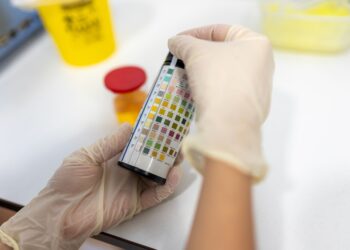 Šlapimo osmolialumo tyrimas