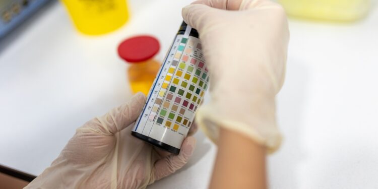 Šlapimo osmolialumo tyrimas